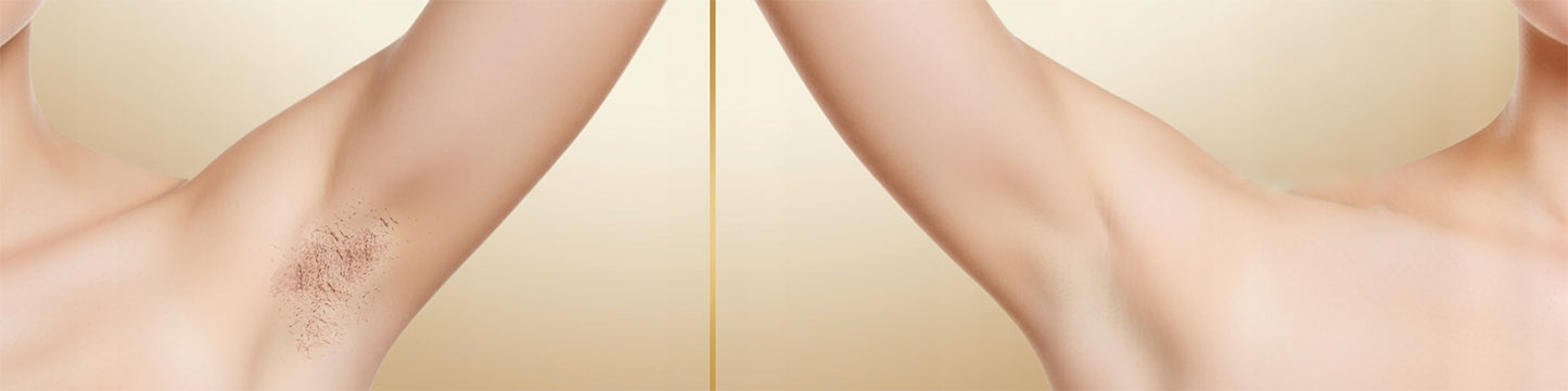 BOSTE IPL lazerinis epiliatorius nuolatinis epiliavimas su odos jutikliu ir vėsinimu