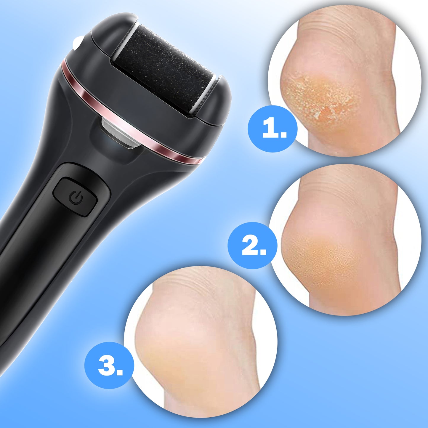 ELEKTRINIS NAGŲ DILDĖ KOJOMS, KULAMS, BEVIELĖ FREZA + PRIEDŲ RINKINYS